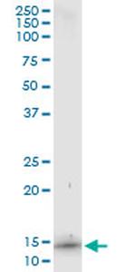 S100A7 Antibody in Immunoprecipitation (IP)