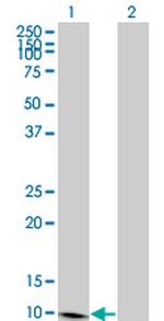 S100A7 Antibody in Western Blot (WB)