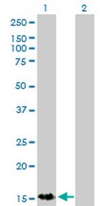 S100A9 Antibody in Western Blot (WB)