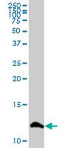 S100A13 Antibody in Western Blot (WB)