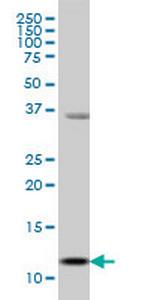 S100A13 Antibody in Western Blot (WB)