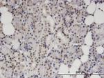 S100B Antibody in Immunohistochemistry (Paraffin) (IHC (P))