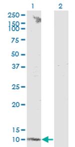 S100B Antibody in Western Blot (WB)