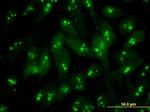 S100B Antibody in Immunocytochemistry (ICC/IF)