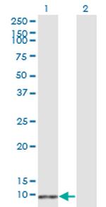 S100B Antibody in Western Blot (WB)