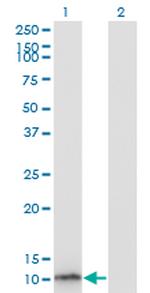 S100B Antibody in Western Blot (WB)