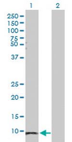 SAA1 Antibody in Western Blot (WB)