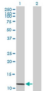 SAA4 Antibody in Western Blot (WB)