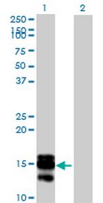 SAA4 Antibody in Western Blot (WB)