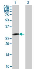 SALL2 Antibody in Western Blot (WB)