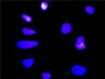 MAPK12 Antibody in Proximity Ligation Assay (PLA) (PLA)