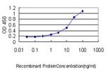 SARS Antibody in ELISA (ELISA)