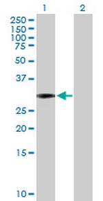 SCML1 Antibody in Western Blot (WB)