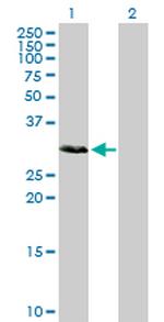 SCML1 Antibody in Western Blot (WB)