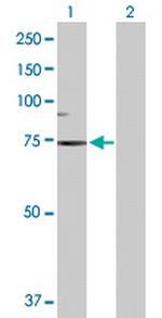 SCNN1B Antibody in Western Blot (WB)