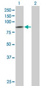 SCNN1D Antibody in Western Blot (WB)