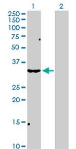 SCP2 Antibody in Western Blot (WB)