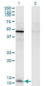 CCL2 Antibody in Western Blot (WB)
