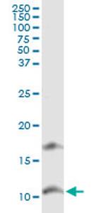 CXCL11 Antibody in Western Blot (WB)