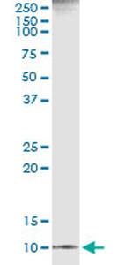 CXCL11 Antibody in Immunoprecipitation (IP)