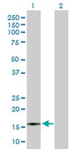 CXCL5 Antibody in Western Blot (WB)