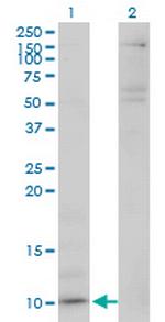 CXCL5 Antibody in Western Blot (WB)