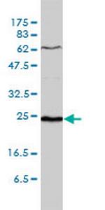 SDF2 Antibody in Western Blot (WB)