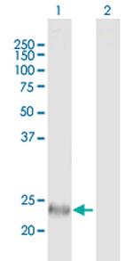 SFRS2 Antibody in Western Blot (WB)