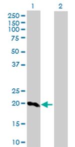 SFTPC Antibody in Western Blot (WB)