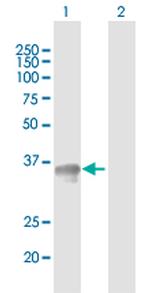 SGCG Antibody in Western Blot (WB)