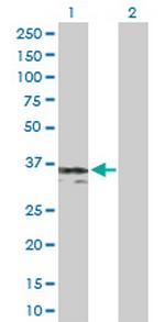 SGCG Antibody in Western Blot (WB)