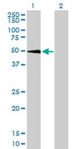 SGK Antibody in Western Blot (WB)