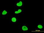 SGK Antibody in Immunocytochemistry (ICC/IF)