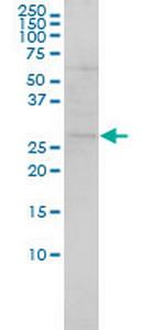 SH3BGR Antibody in Western Blot (WB)