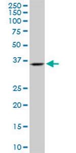 SH3GL2 Antibody in Western Blot (WB)