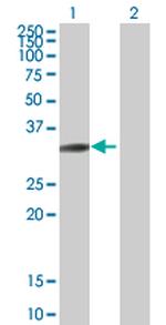 SH3GL3 Antibody in Western Blot (WB)