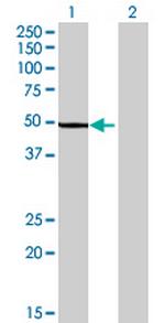 SHMT1 Antibody in Western Blot (WB)