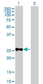 SHOX Antibody in Western Blot (WB)