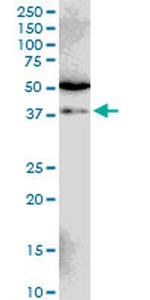 SIAH1 Antibody in Western Blot (WB)