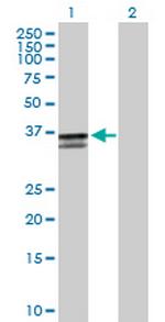 ST3GAL2 Antibody in Western Blot (WB)