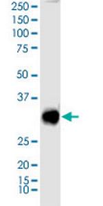 SIX3 Antibody in Western Blot (WB)