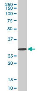 SIX3 Antibody in Western Blot (WB)