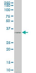 SIX3 Antibody in Western Blot (WB)