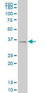 SIX3 Antibody in Western Blot (WB)