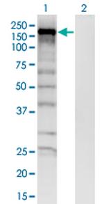 SKIV2L Antibody in Western Blot (WB)