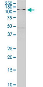 SKIV2L Antibody in Western Blot (WB)