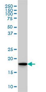 SKP1A Antibody in Western Blot (WB)