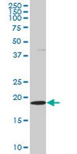 SKP1A Antibody in Western Blot (WB)