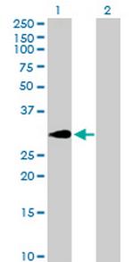 SLA Antibody in Western Blot (WB)