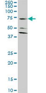 SLC1A2 Antibody in Western Blot (WB)